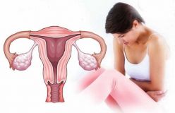 ��� ����� �����: ������ ��� ������